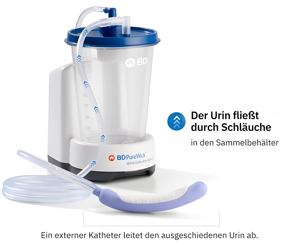 Bild zum Thema: Der Urin fliesst durch Schlaeuche